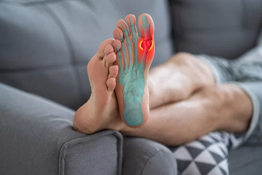 Joint gout pain 